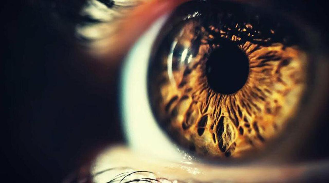 Glaucoma: doença pode causar cegueira